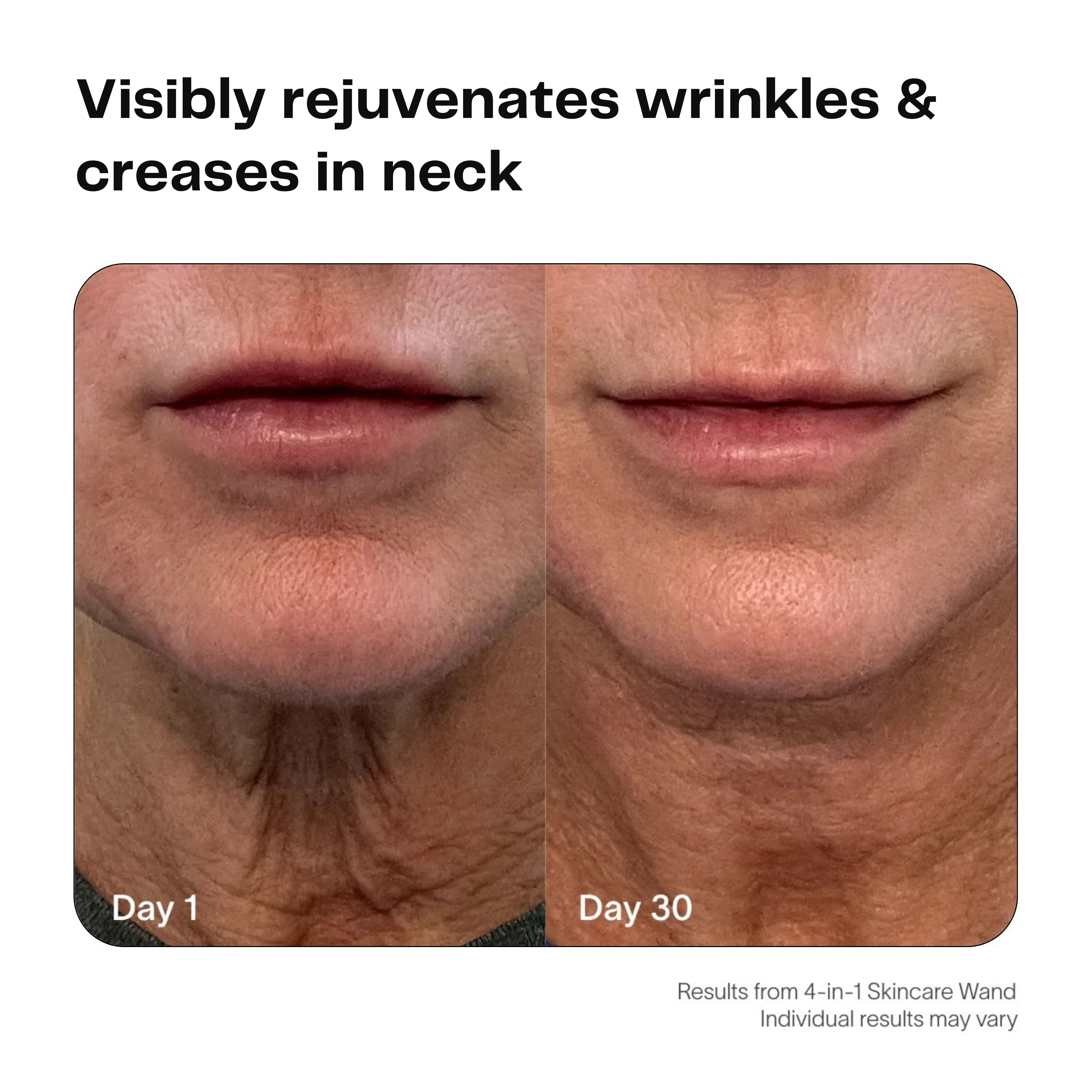 KRAFTI 4-IN-1 SKINCARE WAND